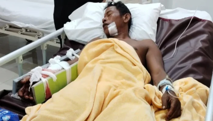 Teror Buaya di Kuala Sungai Ulim Nyelanding, Asmi Alami Luka Serius