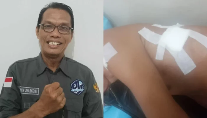 DPD Pro Jurnalismedia Siber Sumsel Meminta Polrestabes Palembang Turun Tangan Tangkap Pelaku Penusukan!
